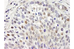 anti-hSET1 (AA 1200-1250) antibody