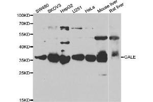 Western blot analysis of extracts of various cell lines, using GALE antibody.