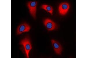 Immunofluorescent analysis of p39 staining in HeLa cells. (p39 (Center) anticorps)