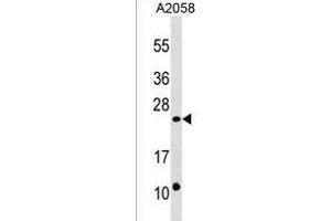 DUSP13 Antibody (C-term) (ABIN1536729 and ABIN2850516) western blot analysis in  cell line lysates (35 μg/lane).