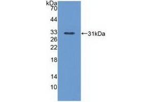 Detection of Recombinant PLCe1, Mouse using Polyclonal Antibody to Phospholipase C Epsilon 1 (PLCe1) (PLCE1 anticorps  (AA 1-250))