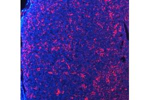 IF analysis of PDCD1 using anti-PDCD1 antibody (ABIN5518784). (PD-1 anticorps  (N-Term))