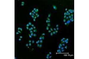 Immunofluorescent analysis (confocal) staining of HeLa cells using Cu/Zn SOD pAb (green), nuclei are stained in blue pseudocolor using DRAQ5. (SOD1 anticorps)