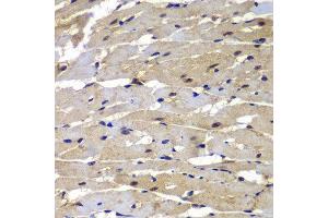 Immunohistochemistry of paraffin-embedded rat heart using PSMB8 antibody.