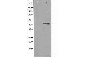 Western blot analysis of extracts from HUVEC cells, using IP3KA antibody. (ITPKA anticorps  (N-Term))