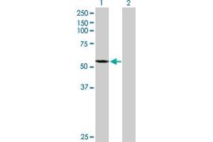 Western Blot analysis of CYP2A7 expression in transfected 293T cell line by CYP2A7 MaxPab polyclonal antibody.