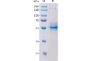 Human T Protein, hFc Tag on SDS-PAGE under reducing condition.