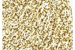 ABIN6269073 at 1/100 staining Human gastric tissue by IHC-P. (ABL1 anticorps)