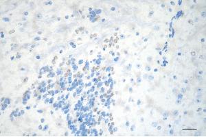 anti-Zinc Fingers and Homeoboxes 2 (ZHX2) antibody