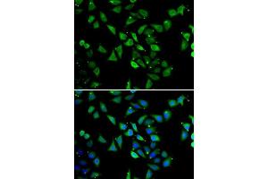 Immunofluorescence analysis of U2OS cells using EIF3C antibody.
