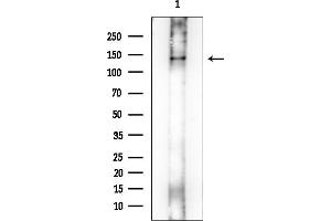 anti-EH Domain Binding Protein 1 (EHBP1) (Internal Region) antibody