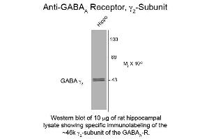Western Blot of Anti-GABA(A) Receptor gamma 2 (Rabbit) Antibody - 112-401-C81 Western Blot of Rabbit Anti-GABA(A) Receptor gamma 2 Antibody. (GABRG2 anticorps)