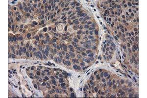 Image no. 17 for anti-Destrin (Actin Depolymerizing Factor) (DSTN) antibody (ABIN1497910) (Destrin anticorps)