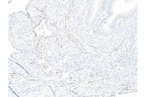 Immunohistochemistry (IHC) image for anti-Selectin P (Granule Membrane Protein 140kDa, Antigen CD62) (SELP) (AA 42-709) antibody (ABIN7795666)