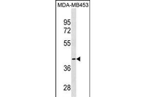 CCBL1 Antibody (C-term) (ABIN1537137 and ABIN2849997) western blot analysis in MDA-M cell line lysates (35 μg/lane). (CCBL1 anticorps  (C-Term))