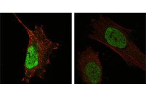 Confocal immunofluorescence analysis of Hela (left) and L-02 (right) cells using MDM4 mouse mAb (green). (MDM4-binding Protein anticorps)