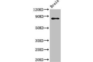 Western Blot Positive WB detected in: Mouse brain tissue All lanes: GIT1 antibody at 3. (GIT1 anticorps  (AA 470-642))