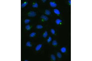 IF analysis of CPI17 alpha using anti-CPI17 alpha antibody (ABIN5518865).