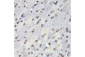 Immunohistochemistry of paraffin-embedded mouse brain using PSMB10 antibody (ABIN6132527, ABIN6146311, ABIN6146312 and ABIN6221107) at dilution of 1:200 (40x lens). (PSMB10 anticorps  (AA 1-273))