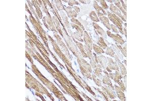 Immunohistochemistry of paraffin-embedded rat heart using NPPA Rabbit pAb (ABIN7268829) at dilution of 1:100 (40x lens).