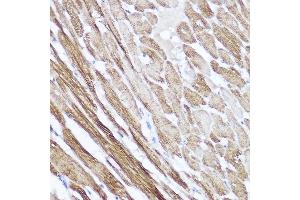 Immunohistochemistry of paraffin-embedded rat heart using NPPA Rabbit pAb (ABIN7268829) at dilution of 1:100 (40x lens). (NPPA anticorps  (AA 26-151))