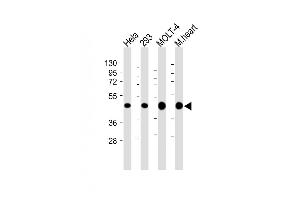 All lanes : Anti-MTHFD2 Antibody (C-term) at 1:4000 dilution Lane 1: Hela whole cell lysate Lane 2: 293 whole cell lysate Lane 3: MOLT-4 whole cell lysate Lane 4: Mouse heart lysate Lysates/proteins at 20 μg per lane. (MTHFD2 anticorps  (C-Term))