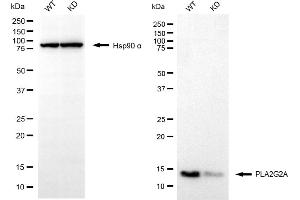 Western blotting analysis using PLA2G2A antibody (ABIN7799821).