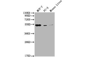 Western Blot Positive WB detected in: MCF-7 whole cell lysate, PC-3 whole cell lysate, Mouse Liver tissue All lanes: MOCS3 antibody at 1:2000 Secondary Goat polyclonal to rabbit IgG at 1/50000 dilution Predicted band size: 50 kDa Observed band size: 50 kDa (MOCS3 anticorps  (AA 279-404))