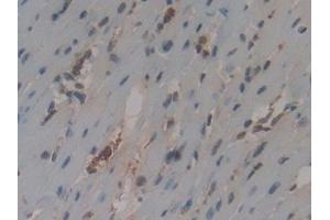 Detection of CYCS in Mouse Heart Tissue using Polyclonal Antibody to Cytochrome C (CYCS)