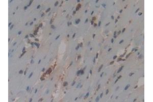Detection of CYCS in Mouse Heart Tissue using Polyclonal Antibody to Cytochrome C (CYCS) (Cytochrome C anticorps  (AA 13-99))