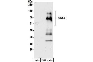 Western Blotting (WB) image for anti-Sialophorin (SPN) (AA 350-400) antibody (ABIN7455030) (CD43 anticorps  (AA 350-400))