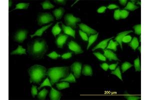Immunofluorescence of monoclonal antibody to NME1 on HeLa cell.