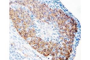 IHC-P: hCG receptor antibody testing of rat ovary tissue (hCG Receptor (N-Term) anticorps)