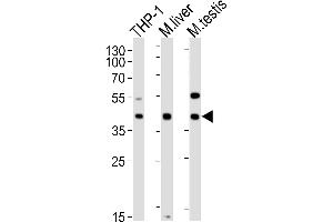 Lane 1: THP-1 Cell lysates, Lane 2: mouse liver lysates, Lane 3: mouse testis lysates, probed with ATG3 (1377CT239.