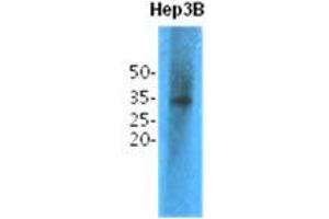 Western Blotting (WB) image for anti-Thiopurine S-Methyltransferase (TPMT) antibody (ABIN781549) (TPMT anticorps)
