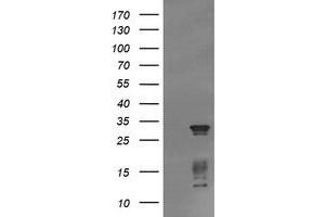 Image no. 2 for anti-Tripartite Motif Containing 38 (TRIM38) (AA 1-265) antibody (ABIN1490682) (TRIM38 anticorps  (AA 1-265))