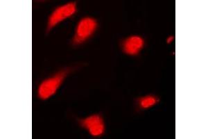 Immunofluorescent analysis of PTTG1/2/3 staining in Jurkat cells. (PTTG1/2/3 anticorps  (Center))