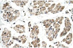 Immunohistochemical staining (Formalin-fixed paraffin-embedded sections) of human muscle with FKTN polyclonal antibody  at 4-8 ug/mL working concentration. (Fukutin anticorps  (N-Term))