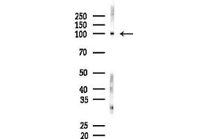 anti-Dystonin (DST) (C-Term) antibody