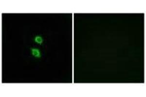 Immunofluorescence analysis of MCF-7 cells, using ARSD antibody. (Arylsulfatase D anticorps)