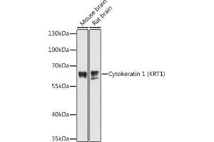 Western blot analysis of extracts of various cell lines, using Cytokeratin 1 (Cytokeratin 1 (KRT1)) antibody (ABIN6127738, ABIN6143011, ABIN6143012 and ABIN6215521) at 1:3000 dilution.