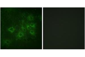 Immunofluorescence analysis of COS7 cells, using Synapsin1 (Phospho-Ser605) Antibody.