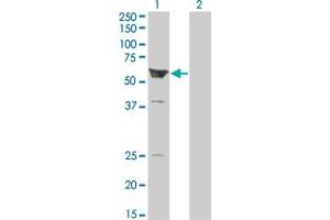 Western Blot analysis of ARHGEF5 expression in transfected 293T cell line by ARHGEF5 monoclonal antibody (M01), clone 3A12-B5. (ARHGEF5 anticorps  (AA 1-519))