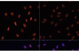 Immunofluorescence analysis of NIH/3T3 cells using Acetyl-Histone H2B-K12 Polyclonal Antibody at dilution of 1:100. (Histone H2B anticorps  (acLys12))