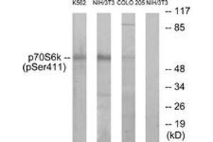 Western Blotting (WB) image for anti-Ribosomal Protein S6 Kinase, 70kDa, Polypeptide 1 (RPS6KB1) (pSer411) antibody (ABIN2888505) (RPS6KB1 anticorps  (pSer411))
