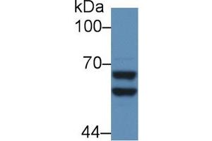 Detection of a2PI in Mouse Liver lysate using Polyclonal Antibody to Alpha 2-Antiplasmin (a2PI) (alpha 2 Antiplasmin anticorps  (AA 348-491))