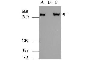 IP Image FASN antibody immunoprecipitates FASN protein in IP experiments. (Fatty Acid Synthase anticorps  (N-Term))
