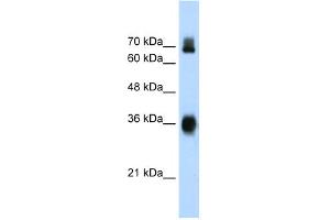 WB Suggested Anti-KEAP1 Antibody Titration:  1. (KEAP1 anticorps  (C-Term))