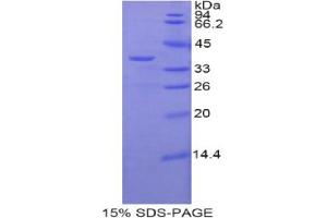 SDS-PAGE analysis of Mouse zAP70 Protein. (ZAP70 Protéine)