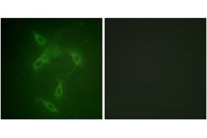 Immunofluorescence analysis of NIH-3T3 cells, using JAK2 (Ab-570) Antibody. (JAK2 anticorps  (AA 541-590))